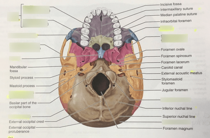 Inferior view of the skull mandible removed