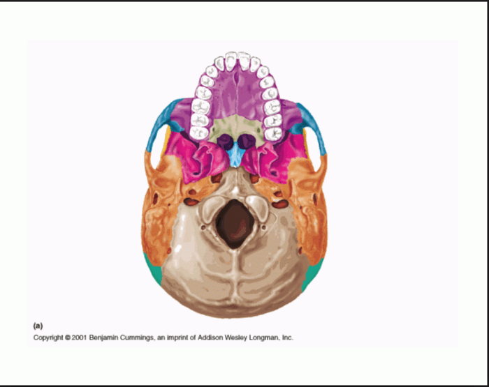 Cranial